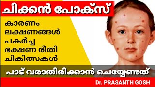 chickenpoxmalayalam ചിക്കൻ പോക്സ് വന്നാൽ  Chickenpox Malayalam Details [upl. by Fleta]