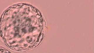 Human Blastocyst Artificial Collapse with Laser Fertility Specialists of Texasavi [upl. by Arrotal]