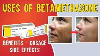 What is Uses of Betamethasone Betaderm Betnovate  betnovate c skin cream  Benefits Dosage [upl. by Joannes]