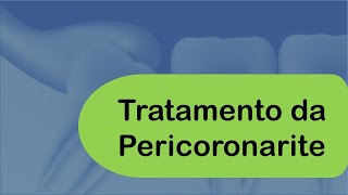 Tratamento da Pericoronarite  Odontologia  Dra Bianca Rosa [upl. by Mikeb750]