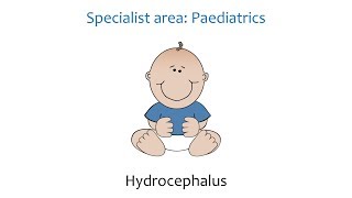 Paediatric Hydrocephalus [upl. by Radnaskela]