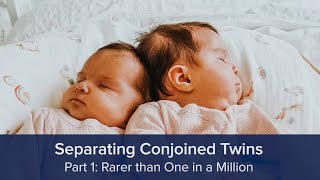 Separating Conjoined Twins Part 1 Rarer than One in a Million [upl. by Ewald]