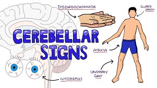 Cerebellar Dysfunction Signs Mnemonic  DANISH What are the Signs of Cerebellar Dysfunction [upl. by Millhon428]