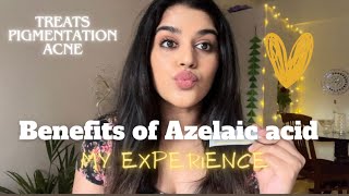 Benefits of Azelaic acid My experience with Azelaic acidAzelaic acid for acne amp Pigmentation acne [upl. by Nerraj]