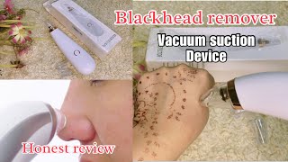 How to use blackhead remover  Acne pore cleaner Vacuum remover [upl. by Zondra858]