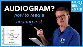 Audiogram  How to Read a Hearing Test [upl. by Aidyn341]