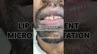 VITILIGO LIP PERMANENT MICROPIGMENTATION  WHITE LIP BLUSHING  SAFEDDAAG LIP TATTOO vitiligoindia [upl. by Josephina]