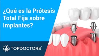 ¿Qué es la Prótesis Total Fija sobre Implantes  Top Doctors [upl. by Av]