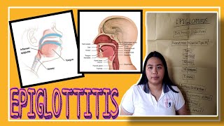 EPIGLOTTITIS  PATHOPHYSIOLOGY [upl. by Earehs]