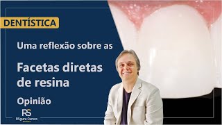 Uma reflexão sobre as Facetas de Resina Composta Opinião [upl. by Neveda563]