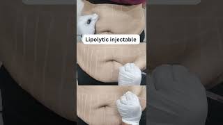 Lipolytic injectable  Lipolysis  Fat reduction bhopal [upl. by Grannia380]