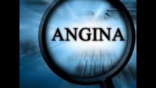 Angina Heart Pain PreventionTreatment Dr NA Mazhar Dr alternative medicine [upl. by Leirad]