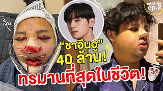 ศัลยกรรมทุบหน้า จำจนวันตาย 40ล้าน ขอเป็นชาอึนอู บวมจนรับไม่ได้ ทรมานที่สุดในชีวิต Ep2lSuperthankky [upl. by Yeblehs]