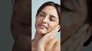 One pharmacy cream that treats 10 problems of skin skincaretips skincare skincareroutine reel [upl. by Ardnasak]