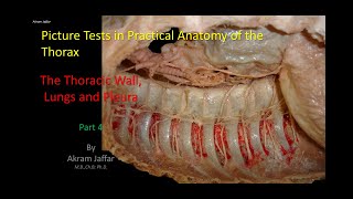 Picture Tests in Anatomy  Thorax  Wall and Lung 4 [upl. by Eissalc]