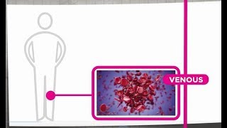 Venous Thrombosis Explained [upl. by Rekrap]