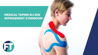 Impingement Syndroom tapen  Medical Taping  FysioTape [upl. by Amol]