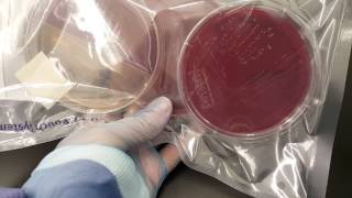 Microbiology Propionibacterium acnes anaerobic set up and colonial growth [upl. by Ettennyl527]