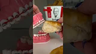 BEST FASTFOOD TO EAT AFTER GETTING BRACES 🦷 KFC EDITION 🫢 ORTHODONTIST REACTS ☝️ [upl. by Ecylahs]