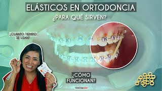 Elásticos en Ortodoncia 😬 ¿Para qué sirven ¿Cómo funcionan  Odontología Láser 🦷 [upl. by Azile]