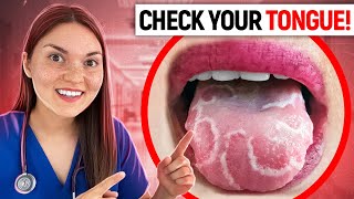 What your TONGUE says about your HEALTH Doctor Explains [upl. by Allegna]