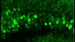 Monitoring neuronal activity in brain slices from a 2 year old Thy1GCaMP3 transgenic mouse [upl. by Aztinad]