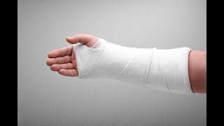 Broken Hand Symptoms and Causes  Diagnosis  Treatment  Prevention disease healthcare healthy [upl. by Esihcoc]