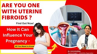 Uterine Fibroids and Pregnancy Understanding the Impact and Potential Complications  Dr BKN Sudha [upl. by Yarak]