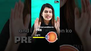 Cataract and Presbyopia Explained in 40 Seconds shorts class10th class10thscience [upl. by Ayik325]