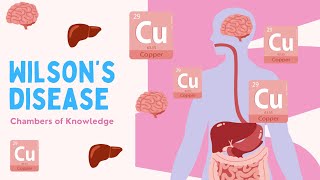 Wilson’s Disease From Diagnosis to Management – What You Need to Know [upl. by Olfe]