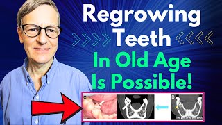 Regrowing Teeth In Old Age Is Possible Human Trial Starts This Year [upl. by Maziar841]