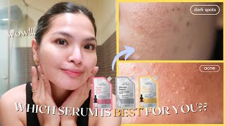 ANO ANG THE BEST SERUM FOR YOU 🤔 LUXE ORGANIX SERUMS SIMPLIFIED • Joselle Alandy [upl. by Thurstan]