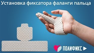 УСТАНОВКА ФИКСАТОРА ДЛЯ ФАЛАНГИ ПАЛЬЦЕВ РУКИ [upl. by Carrew]