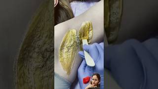 beauty waxing skincare satisfying viralvideos beautytips hardwax brazilianwaxingunderarm🥹❤ [upl. by Lirva]