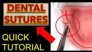 ALL SUTURES Tips to LEARN FAST Dental Suture Techniques  Oral Surgery  Dentistry Suturing [upl. by Sachs]