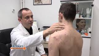 Akne  Dr Dimitrije Karabahčiev dermatovenerolog  Dermamedicus Beograd [upl. by Akcimahs]