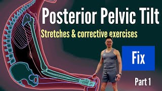 Posterior pelvic tilt  Posterior Pelvic tilt stretches amp corrective exercises [upl. by Aibara927]