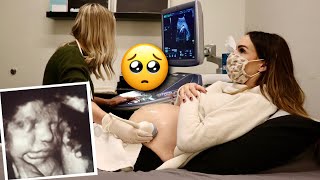 SEEING OUR BABYS FACE FOR THE FIRST TIME SPECIAL 4D BABY ULTRASOUND [upl. by Shir]