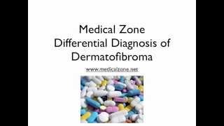 Medical Zone  Differential Diagnosis of Dermatofibroma [upl. by Yeltsew]