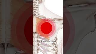 Trigger Point Therapy  The Anterior Deltoid [upl. by Reve]