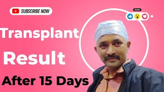 Day 1 To Day 15 Hair Transplant Journey [upl. by Haskell]