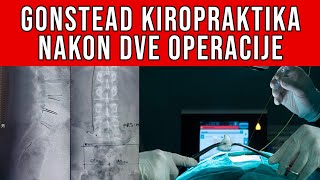 Kiropraktika nakon dve operacije diskus hernije Diskus hernija L4L5 [upl. by Keithley]