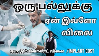 fixed பல் இம்பிளாண்ட் சிகிச்சை ஒரு பல் கட்ட செலவு என்ன𝐬𝐢𝐧𝐠𝐥𝐞 𝐭𝐞𝐞𝐭𝐡 𝐃𝐞𝐧𝐭𝐚𝐥 𝐈𝐦𝐩𝐥𝐚𝐧𝐭 𝐜𝐨𝐬𝐭 𝐢𝐧 𝐓𝐚𝐦𝐢𝐥 [upl. by Infield]