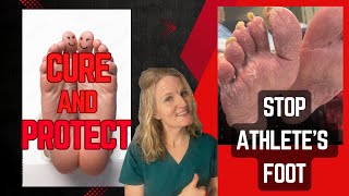 Stop Athletes Foot Podiatrists 4 Proven Ways to Cure and Prevent it plus natural remedies [upl. by Bakerman]