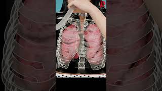 The Truth About Incentive Spirometry Doctor Explained [upl. by Deth706]