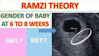 GENDER DETECTION AT 6 TO 8 WEEKS SCAN GENDER DETECTION AT EARLIER SCAN  RAMZI THEORY BOY OR GIRL [upl. by Yarazed871]