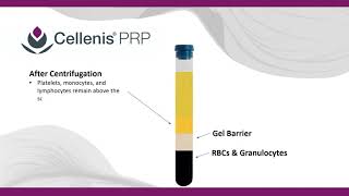 Cellenis PRP for patients How it works [upl. by Witcher]