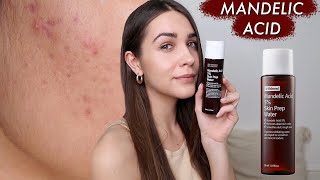 HOW TO USE MANDELIC ACID IN YOUR SKINCARE ROUTINE  GIVEAWAY [upl. by Nylknarf]