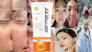 Dermarex Soft Silicone Sunscreen Gel SPF 50  Honest Review [upl. by Durrett]