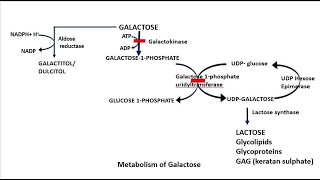 Galactosemia Galactosemic children tend to develop premature cataracts [upl. by Ysdnil510]